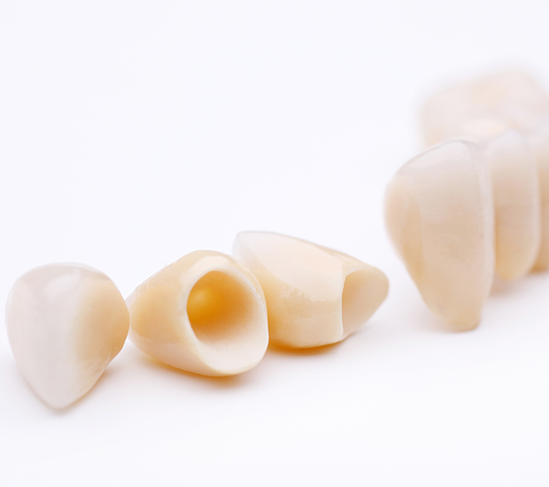 Southfield Dental Crowns and Dental Bridges