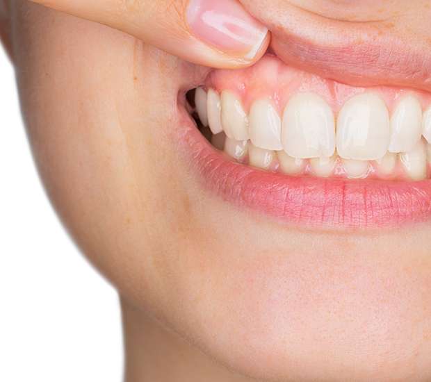 Southfield Gum Disease