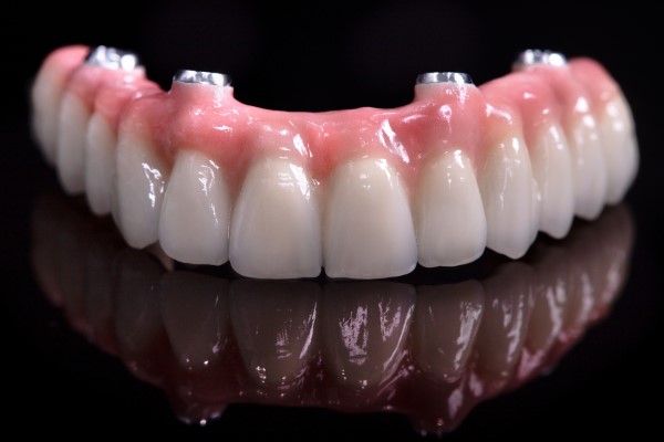 Implant Supported Dentures Southfield, MI
