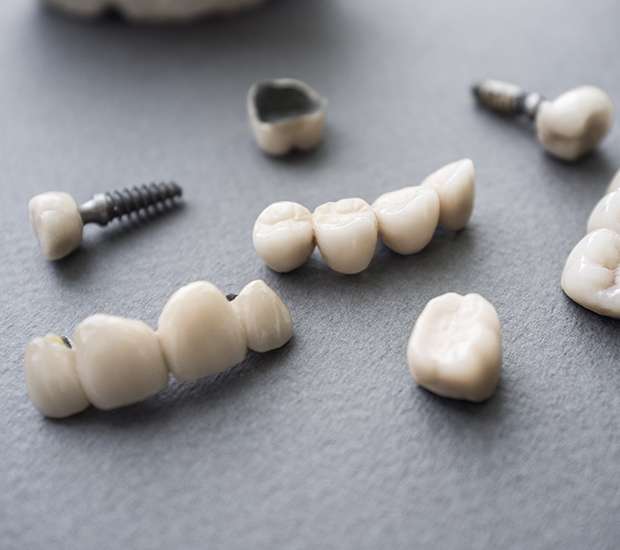 Southfield The Difference Between Dental Implants and Mini Dental Implants