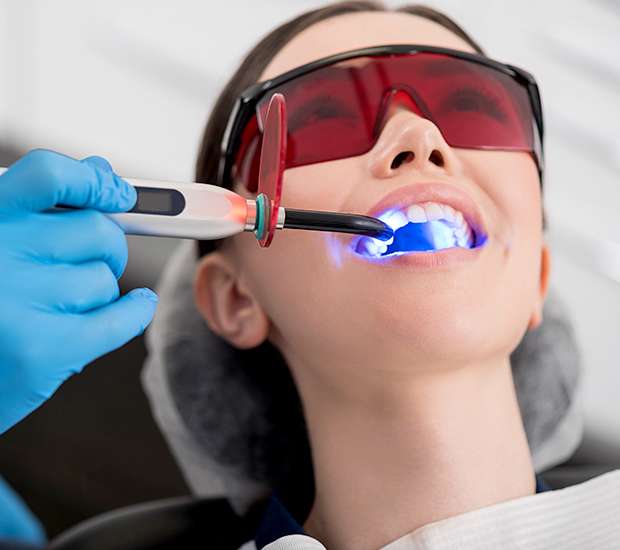 Southfield Professional Teeth Whitening